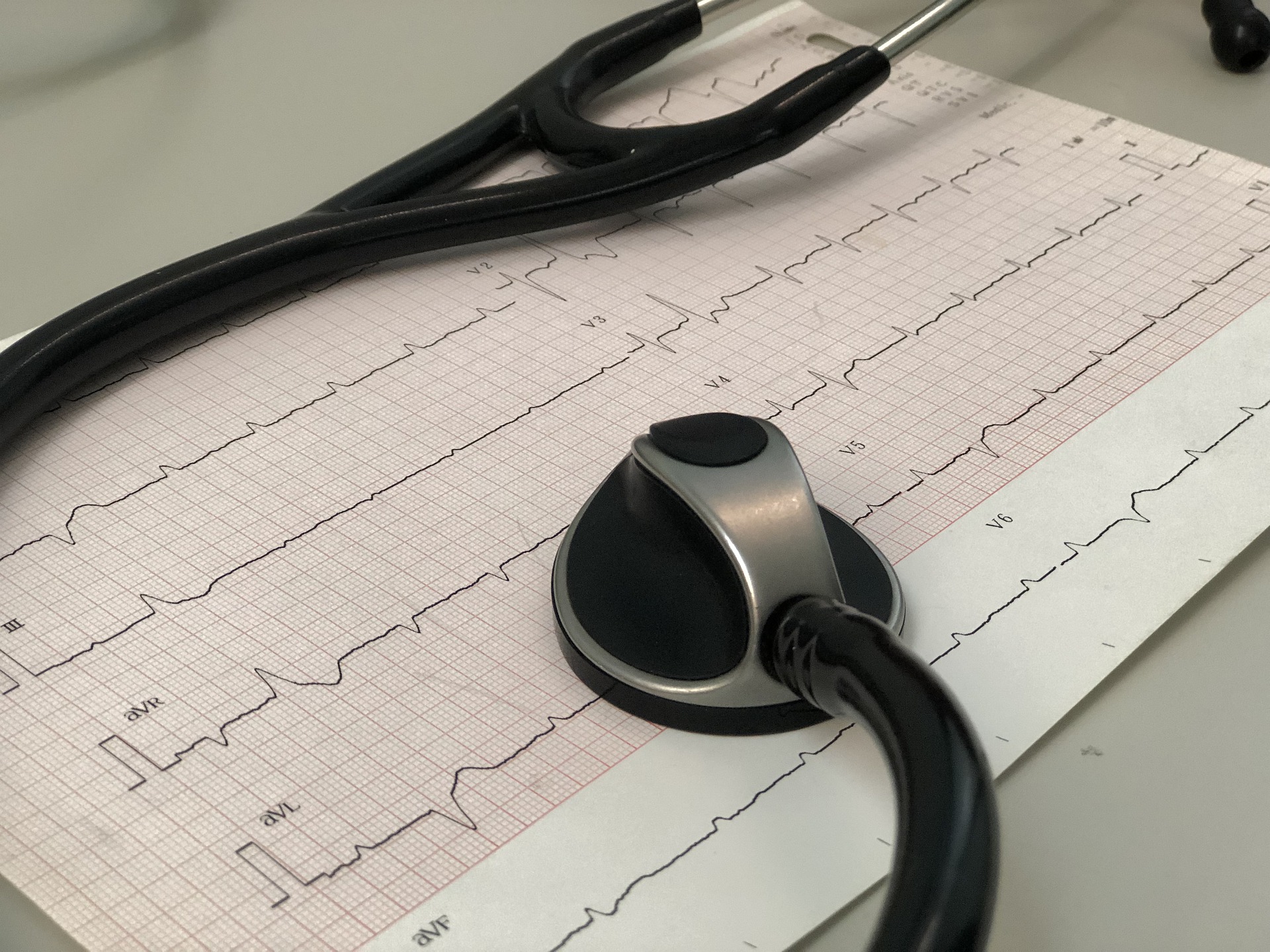 Picture of EKG printout